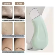 Hoorix® Blackhead Remover  Deep Pore Face Cleaner